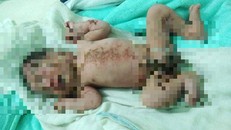 Phát hiện bé trai còn nguyên dây rốn bị bỏ bên bờ suối 