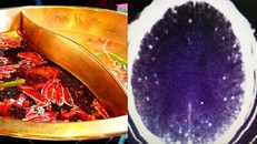 Người đàn ông bị sán dây bò lên não vì ăn lẩu