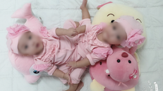 Chuẩn bị mổ tách cặp song sinh dính liền vùng bụng chậu
