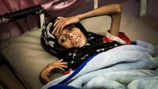 Sadia Ibrahim Mahmud, khi đó 11 tuổi, trên giường bệnh vào tháng 9 năm 2019. Cô bé đã qua đời không lâu sau đó. Ảnh: The Guardian