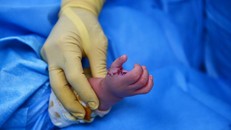 'Phù thủy của những bàn tay' trở lại Việt Nam phẫu thuật cho trẻ em nghèo ​