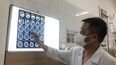 Vụ 37 công nhân nhiễm độc methanol: Chuyên gia khuyến cáo cách phòng tránh