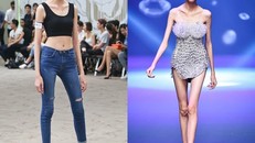 Hình ảnh trước và sau khi gặp tai nạn của Cao Ngân.