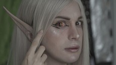 Chàng trai chi 60.000 USD để phẫu thuật thành yêu tinh