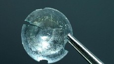 Kính sát tròng nằm trong mắt 28 năm sau va chạm