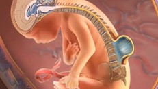 Nứt đốt sống khiến tuỷ sống tràn ra ngoài khiến trẻ có nguy cơ tàn tật rất lớn khi sinh ra