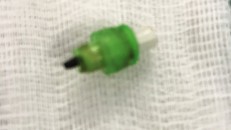 Dị vật là ruột bút chì được lấy ra