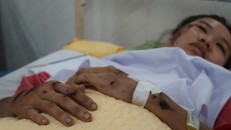 Một nạn nhân đang được theo dõi tại Bệnh viện Chợ Rẫy