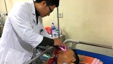 Nạn nhân nặng nhất đang điều trị tại BV Việt Đức