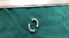 Bé trai 11 tuổi suýt bị hoại tử 'của quý' vì nghịch dại