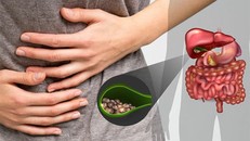 Sỏi mật là một trong các bệnh dễ gây nên các biến chứng nguy hiểm.