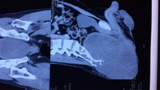 Phim chụp khối u của bệnh nhân. (Ảnh: PV/Vietnam+)