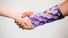 Khuôn bó bột kiểu mới không gây ngứa, không mùi, không cần cắt bằng cưa