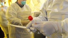 Nhân viên y tế sử dụng bộ xét nghiệm RT-PCR nhằm phát hiện bệnh nhân nhiễm COVID-19 tại Newton, Massachusetts (Mỹ) ngày 18/3/2020. Ảnh: AFP/TTXVN