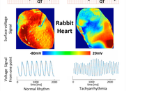 Hình ảnh cho thấy bề mặt điện áp trên tim thỏ không có HCQ là bình thường, kích hoạt điện lan truyền đồng nhất; trong khi với HCQ, sóng lan truyền không đều, tạo ra các mô hình phức tạp và rối loạn nhịp tim.