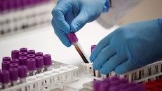 Các nhà nghiên cứu Chile tuyên bố đã phát hiện kháng thể "mạnh nhất thế giới" có khả năng chống lại virus SARS-CoV-2 - (Ảnh: REUTERS).