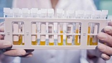 Huyết tương của người khỏi Covid-19 có thể mang lại sự sống cho bệnh nhân nhiễm Covid-19