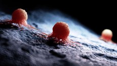 Tìm ra cách tiêu diệt tế bào ung thư mà không cần thuốc