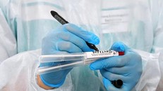 Mất khứu giác do mắc Covid-19 sẽ có phản ứng miễn dịch mạnh hơn?