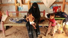 Trẻ em bị suy dinh dưỡng do nạn đói kéo dài ở Hajjah, Yemen. Ảnh: AFP/TTXVN