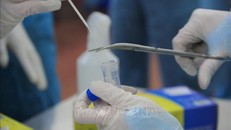 Không sử dụng xét nghiệm kháng thể SARS-CoV-2 sai mục đích, không cần thiết