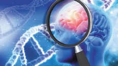 Nhật Bản phát hiện đặc điểm di truyền của người dễ mắc bệnh Alzheimer