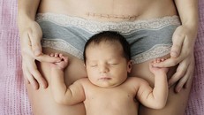 Thụy Sĩ nằm trong số các nước có tỷ lệ sinh mổ cao nhất tại châu Âu