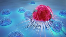 Israel điều trị ung thư máu bằng liệu pháp tế bào biến đổi gene