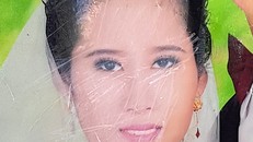 Ảnh của Nguyễn Thị Thảo bị mẹ chồng dùng vật cứng cắt nát. (Ảnh: Zing.vn)