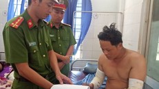 Đối tượng Thụ thời điểm còn điều trị bỏng tại bệnh viện.