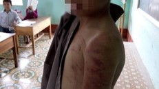 Cháu bé mồ côi bị sư thầy hành hạ: Đề nghị công an vào cuộc