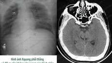 Tài xế hôn mê sâu khi lái xe chỉ vì quên ăn sáng