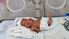 Em bé nặng 900 g được nuôi dưỡng thành công tại Bệnh viện Đa khoa huyện Bắc Hà. (Ảnh: Bệnh viện cung cấp)