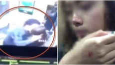 Nạn nhân trước và sau khi bị cưỡng hôn trong thang máy