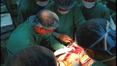 Ê kíp phẫu thuật do GS.TS Phạm Như Hiệp, Giám đốc Bệnh viện Trung ương Huế, trực tiếp làm kíp trưởng thực hiện. (Ảnh: Nhật Tân)