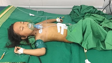 Cứu sống bệnh nhi ‘được’ ông nội khâu vết thương bằng chỉ may vá