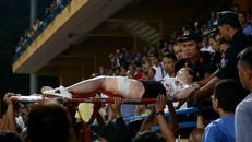 Trúng pháo sáng trên sân Hàng Đẫy, nữ cổ động viên phải trải qua 2 cuộc phẫu thuật