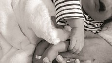 Đình chỉ bác sĩ siêu âm tắc trách khiến bé trai chào đời không có mắt, mũi