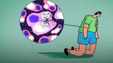 Vì sao không uống rượu bia vẫn ung thư gan?