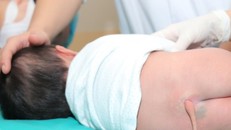 Chiếc đuôi thừa có kích thước lớn dần lên theo sự phát triển của trẻ.