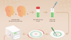 Các bước xét nghiệm nhanh nCoV