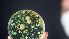 Siêu khuẩn nguy hiểm mới đang lây lan