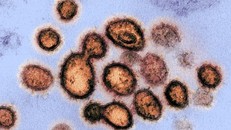 nCoV khi quan sát dưới kính hiển vi. - Ảnh: SCMP.