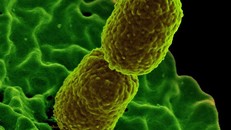 Phát hiện chất trong ruột giúp ngăn nhiễm trùng do vi khuẩn