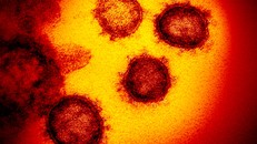 Một bệnh nhân tử vong sau khi được ghép phổi nhiễm virus corona