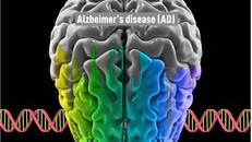 Phát hiện mới về nguyên nhân gây bệnh Alzheimer