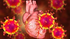 Cảnh báo biến chứng viêm cơ tim ở trẻ hậu Covid-19