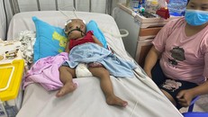 Trẻ mắc bệnh hô hấp tăng, tỷ lệ trẻ tái nhiễm cao