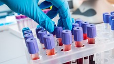 Xét nghiệm máu có thể phát hiện ung thư sớm