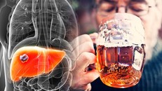 Tiêu thụ quá nhiều nước ngọt làm tăng nguy cơ mắc bệnh thận 